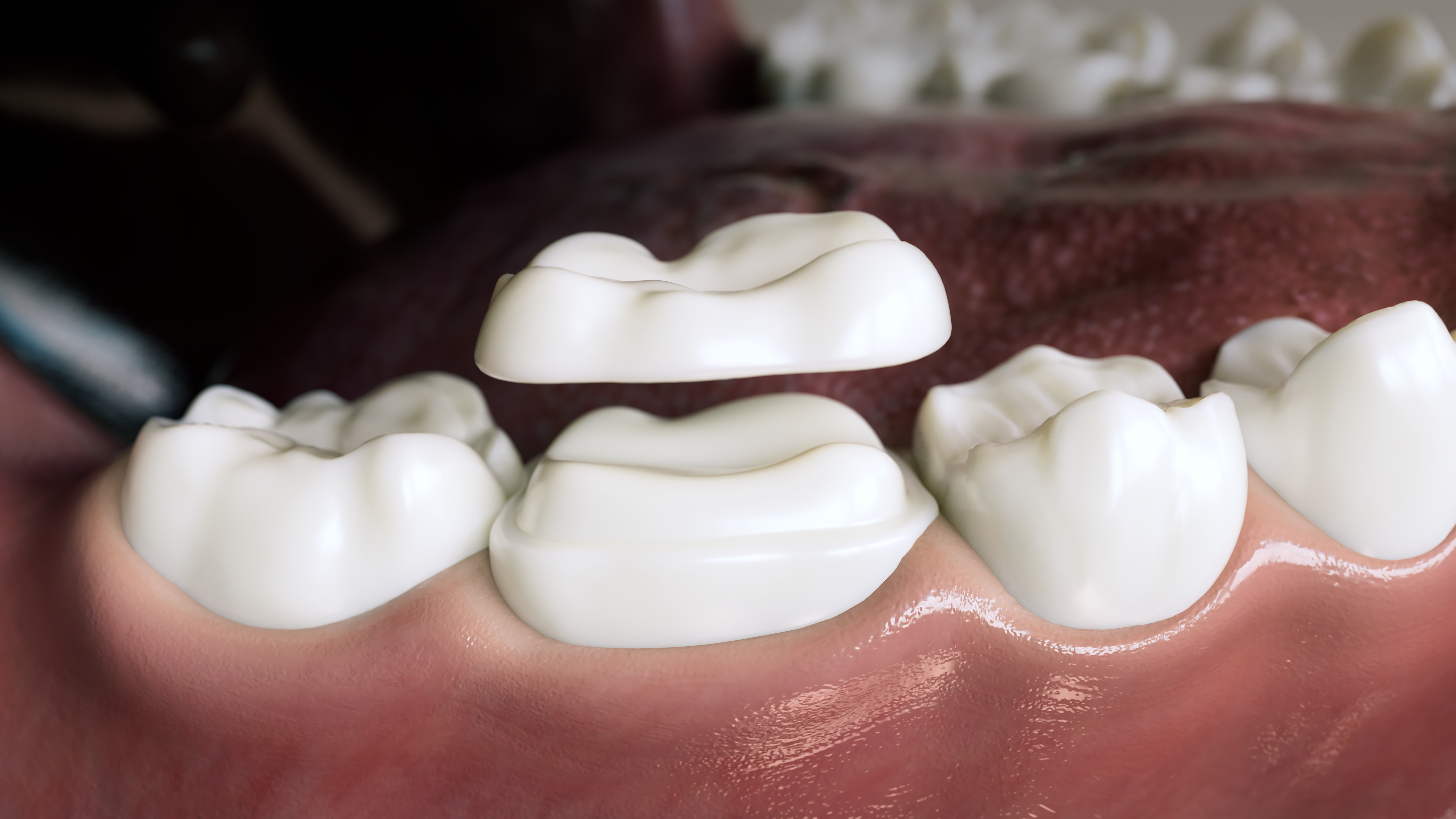 Emery L. Edwards DDS