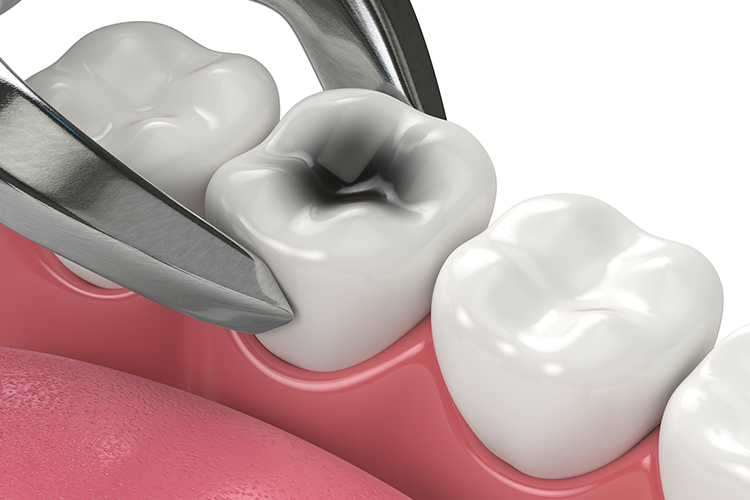 Emery L. Edwards DDS